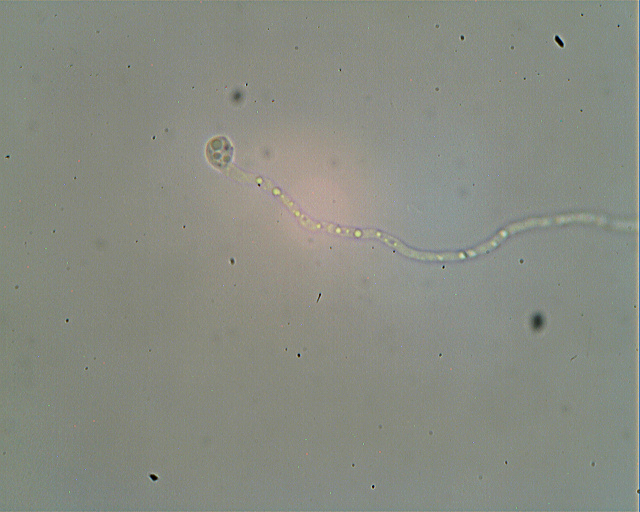 Asterostroma laxum Bres. (1920)